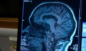 abd-20-yil-sonra-birinci-sefer-yeni-bir-alzheimer-ilacini-onayladi-a1rK1zOk.jpg