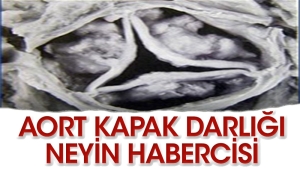 aort-kapagindaki-daralma-neyin-habercisi-tELEEy5g.jpg