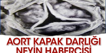 aort-kapagindaki-daralma-neyin-habercisi-tELEEy5g.jpg