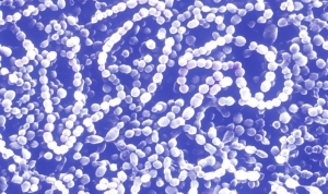 arastirma-sepsis-hastaligi-dunyada-her-bes-vefattan-birine-neden-oluyor-nU6w1Dd3.jpg