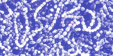arastirma-sepsis-hastaligi-dunyada-her-bes-vefattan-birine-neden-oluyor-nU6w1Dd3.jpg