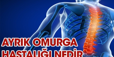 ayrik-omurga-hastaligi-nedir-XSqcRCpq.jpg