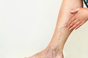 bacaklarda-agri-sislik-ve-huzursuzluk-varsa-dikkat-Wmh7QyJU.jpg