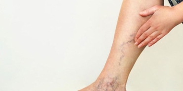 bacaklarda-agri-sislik-ve-huzursuzluk-varsa-dikkat-Wmh7QyJU.jpg