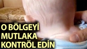 bebekte-ense-kalinligina-dikkat-63d3eIO8.jpg