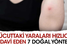 bedendeki-yaralari-suratlice-tedavi-eden-7-dogal-prosedur-OsX4IyNO.jpg