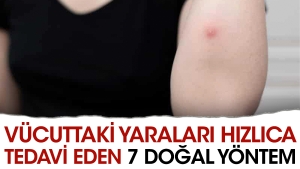 bedendeki-yaralari-suratlice-tedavi-eden-7-dogal-prosedur-OsX4IyNO.jpg