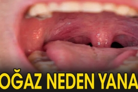 bogazimiz-neden-yanar-6s22gGyb.jpg