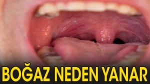 bogazimiz-neden-yanar-6s22gGyb.jpg