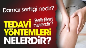damar-sertligi-nedir-damar-sertligi-belirtileri-nelerdir-damar-sertligi-tedavi-yollari-nelerdir-svdWX21l.jpg