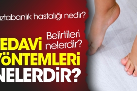 duztabanlik-hastaligi-nedir-belirtileri-nelerdir-tedavi-sistemleri-nelerdir-cCjOQ6OL.jpg