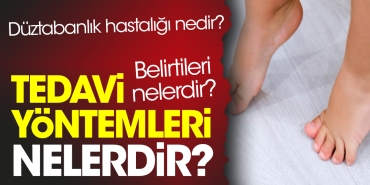 duztabanlik-hastaligi-nedir-belirtileri-nelerdir-tedavi-sistemleri-nelerdir-cCjOQ6OL.jpg
