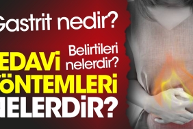 gastrit-nedir-belirtileri-nelerdir-tedavi-usulleri-nelerdir-5aDEzEEu.jpg
