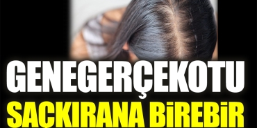 genegercekotu-sackirana-birebir-lzjFLi9d.jpg