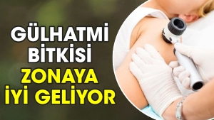 gulhatmi-bitkisi-zonaya-l-geliyor-18UhK1il.jpg