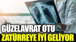 guzelavrat-otu-zaturreye-l-geliyor-22CPCwQq.jpg