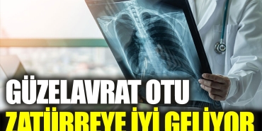 guzelavrat-otu-zaturreye-l-geliyor-22CPCwQq.jpg