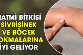 hatmi-bitkisi-sivrisinek-ve-bocek-sokmalarina-yeterli-geliyor-GqJJTyRj.jpg