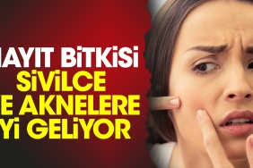 hayit-bitkisi-sivilce-ve-aknelere-guzel-geliyor-cIfewTBP.jpg