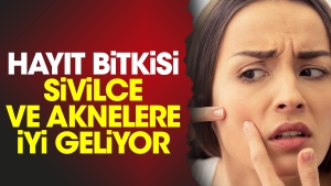 hayit-bitkisi-sivilce-ve-aknelere-guzel-geliyor-cIfewTBP.jpg