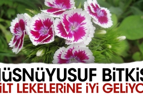husnuyusuf-bitkisi-cilt-lekelerine-uygun-geliyor-YsPwHSSF.jpg