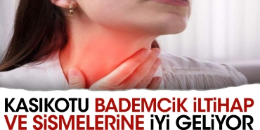 kasikotu-bademcik-iltihap-ve-sismelerine-duzgun-geliyor-X2RVsZUC.jpg