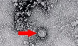koronavirusun-basladigi-cinden-bir-virus-daha-cikti-7-kisi-hayatini-kaybetti-hKxM2OWw.jpg