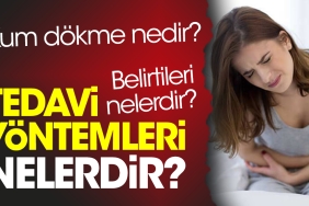 kum-dokme-nedir-kum-dokme-belirtileri-nelerdir-kum-dokme-tedavi-metotlari-nelerdir-rEKdUIjx.jpg