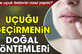 meskende-ucuk-tedavisi-nasil-yapilir-ucugu-gecirmenin-dogal-formulleri-SNI17Ltm.jpg