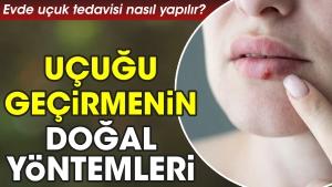 meskende-ucuk-tedavisi-nasil-yapilir-ucugu-gecirmenin-dogal-formulleri-SNI17Ltm.jpg