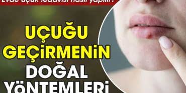 meskende-ucuk-tedavisi-nasil-yapilir-ucugu-gecirmenin-dogal-formulleri-SNI17Ltm.jpg