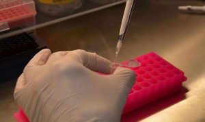 rahim-agzi-kanserine-neden-olan-hpv-virusu-icin-asi-onerisi-RLSvyHgL.jpg