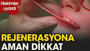 rejenerasyon-usulu-nedir-l66p6w5V.jpg