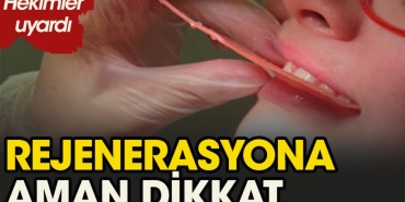 rejenerasyon-usulu-nedir-l66p6w5V.jpg