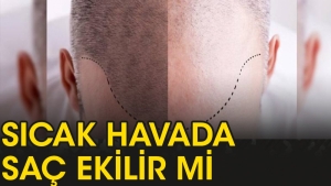 sicak-havalarda-sac-ekilir-mi-hQa12C6v.jpg