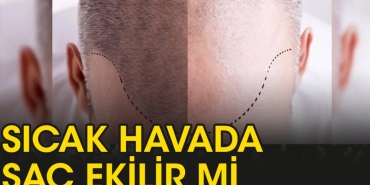 sicak-havalarda-sac-ekilir-mi-hQa12C6v.jpg