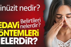sinuzit-nedir-sinuzit-belirtileri-nelerdir-sinuzit-tedavi-teknikleri-nelerdir-d6x5YJNJ.jpg