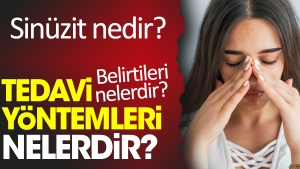 sinuzit-nedir-sinuzit-belirtileri-nelerdir-sinuzit-tedavi-teknikleri-nelerdir-d6x5YJNJ.jpg