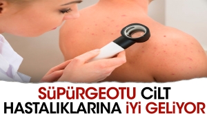 supurgeotu-cilt-hastaliklarina-yeterli-geliyor-jtfqekA6.jpg