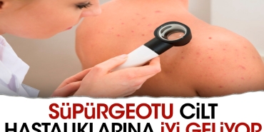 supurgeotu-cilt-hastaliklarina-yeterli-geliyor-jtfqekA6.jpg