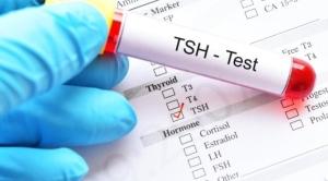 tsh-thyroid-stimulating-hormone-yukselten-besinler-nelerdir-jHQHEUcG.jpg