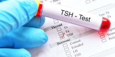 tsh-thyroid-stimulating-hormone-yukselten-besinler-nelerdir-jHQHEUcG.jpg