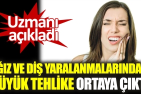 uzmani-acikladi-agiz-ve-dis-yaralanmalarindaki-buyuk-tehlike-ortaya-cikti-IeAfvLrP.jpg