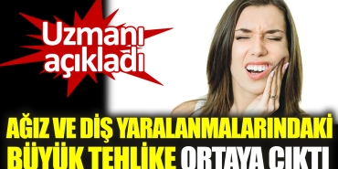 uzmani-acikladi-agiz-ve-dis-yaralanmalarindaki-buyuk-tehlike-ortaya-cikti-IeAfvLrP.jpg