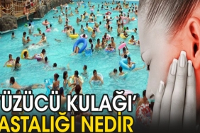 yuzucu-kulagi-hastaligi-nedir-bVv77QpB.jpg