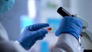 1-aralik-dunya-aids-gunu-aids-nedir-belirtileri-nelerdir-hxqLMtBJ.jpg
