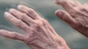 11-nisan-dunya-parkinson-gunu-parkinson-nedir-parkinson-belirtileri-ve-tedavisi-QIzeHZI4.jpg