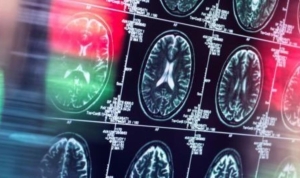 ab-tarihi-alzheimer-ilacina-ruhsat-vermedi-faydasi-riskleri-gormezden-gelecek-kadar-degil-OUlOBe8R.jpg