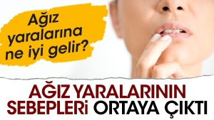 agiz-yaralarinin-sebepleri-ortaya-cikti-agiz-yaralarina-ne-yeterli-gelir-KjCf71YN.jpg