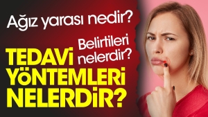 agiz-yarasi-nedir-agiz-yarasi-belirtileri-nelerdir-agiz-yarasi-tedavi-metotlari-nelerdir-NfXy2VOH.jpg
